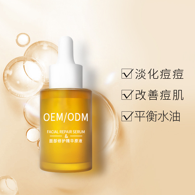 苏州市_祛痘精华原液OEM